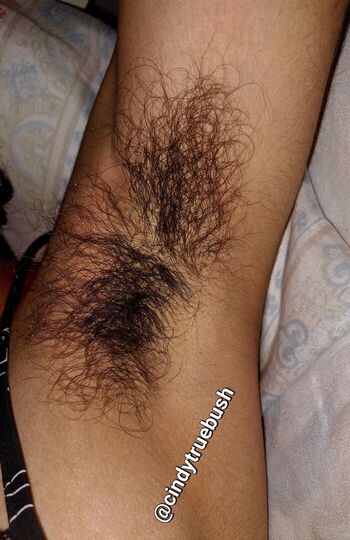 Hairy Women