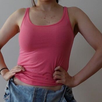 Loserfruit